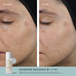 Acid Milk Toner